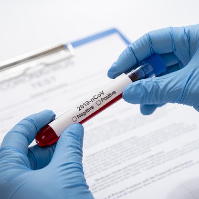 Vin veștile bune! Sanofi și Regeneron testează clinic un medicament împotriva Covid-19