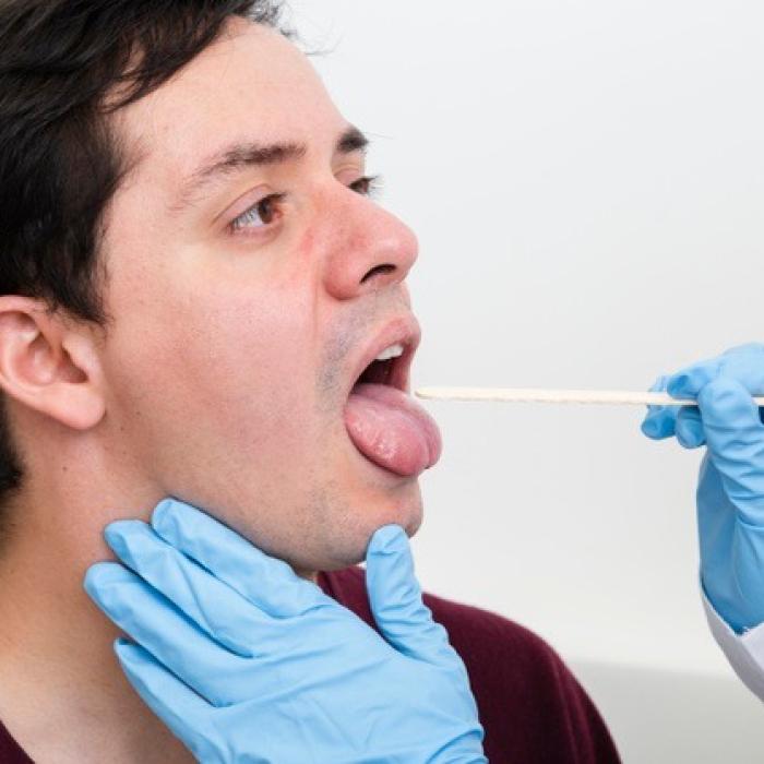 COVID-19: Aceste SEMNE pe limbă sunt un NOU SIMPTOM