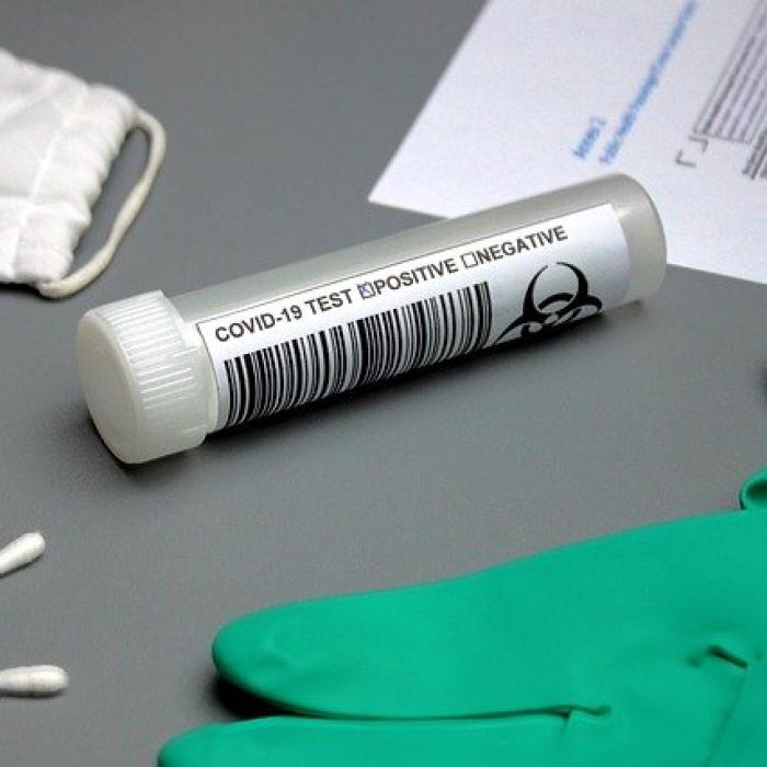 Covid-19: Cel mai RAPID test este INVENTAT în India