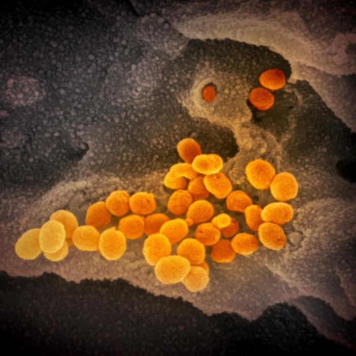 Epidemiolog francez: Virusul circulă din ce în ce mai rapid