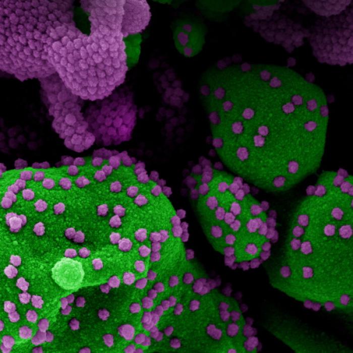 Covid-19. Veste EXTRAORDINARĂ. Un medicament care tratează