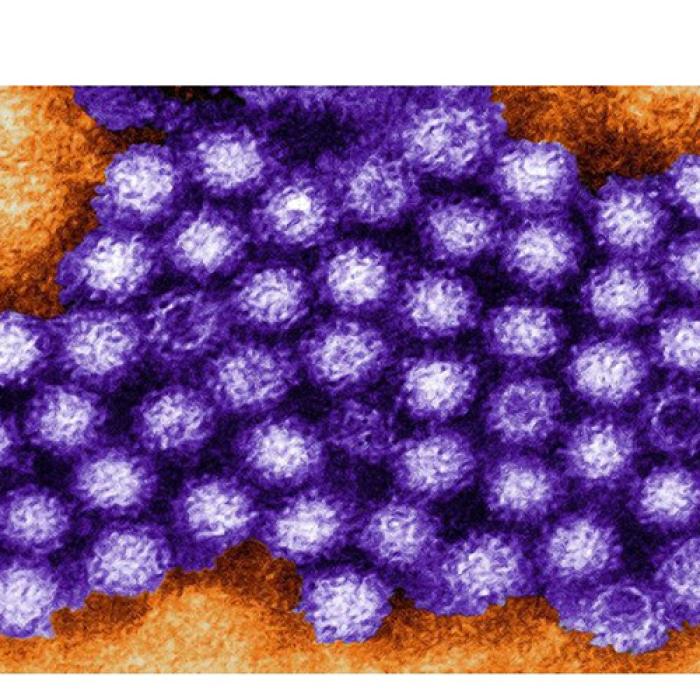 Un alt VIRUS, rezistent la alcool, face RAVAGII în Marea Britanie