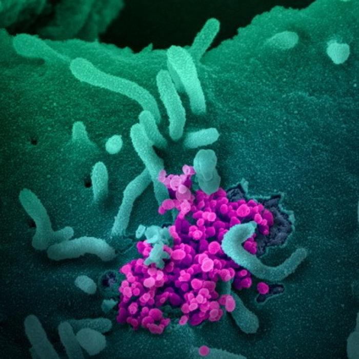 COVID-19: Creștere NEOBIȘNUITĂ a numărului de cazuri în această țară