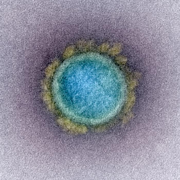 COVID-19. După Delta, varianta Lambda se anunță și mai periculoasă