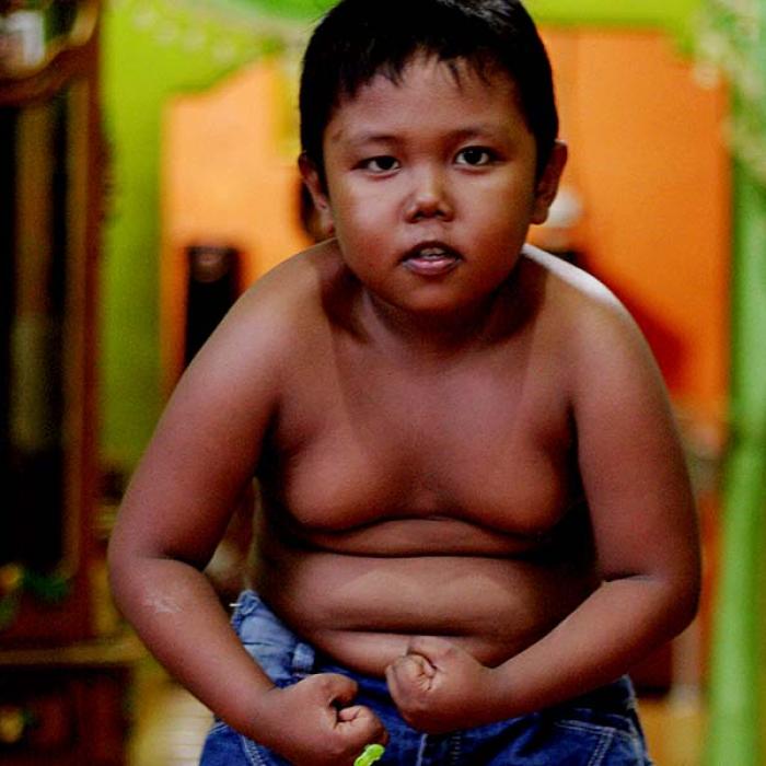 Raport: Nestle a subminat eforturile guvernului mexican în lupta cu obezitatea