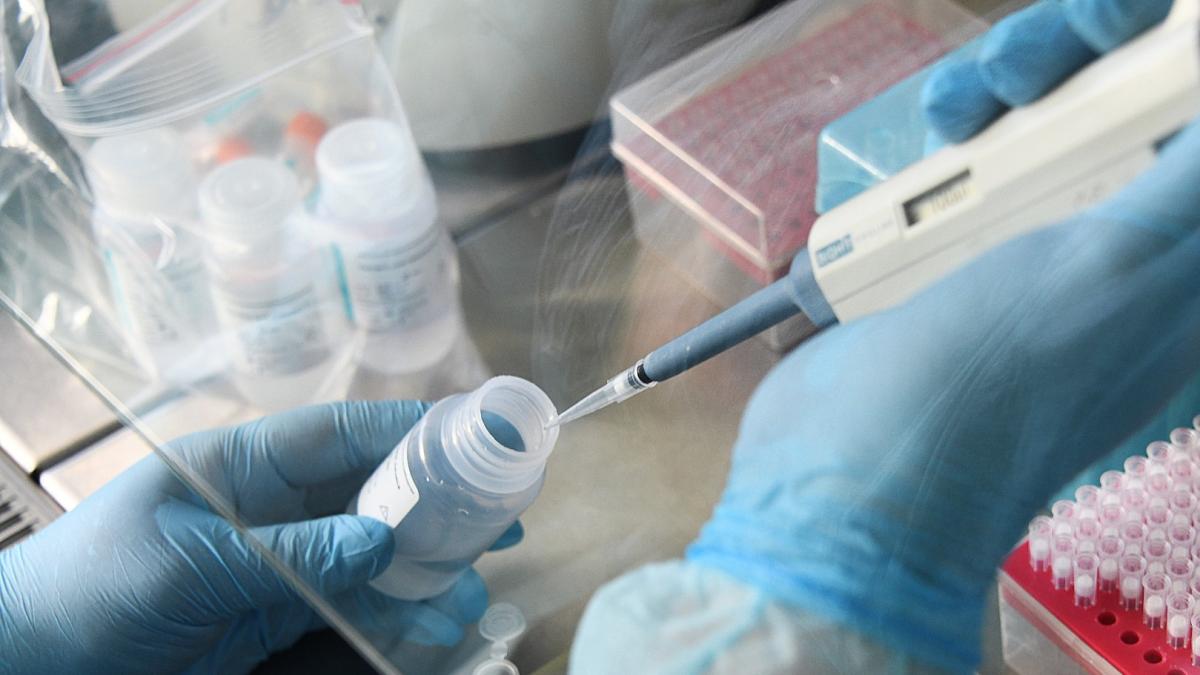 coronavirus_21240100