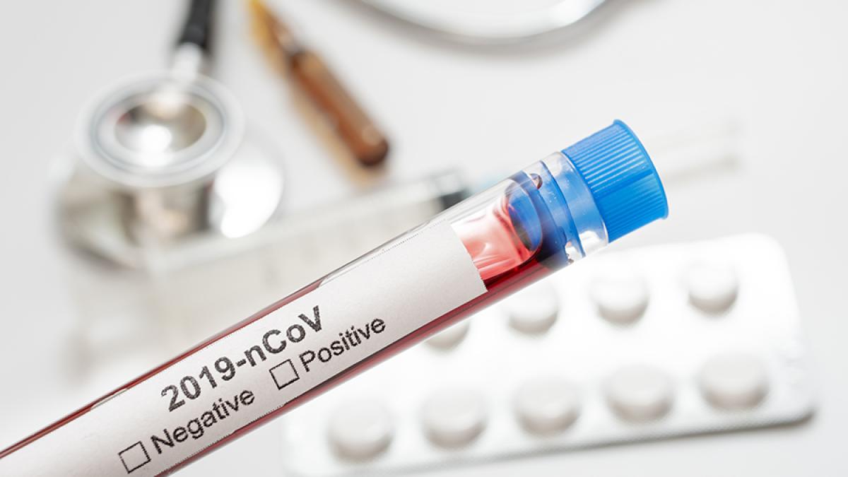 test_covid_19_75130100