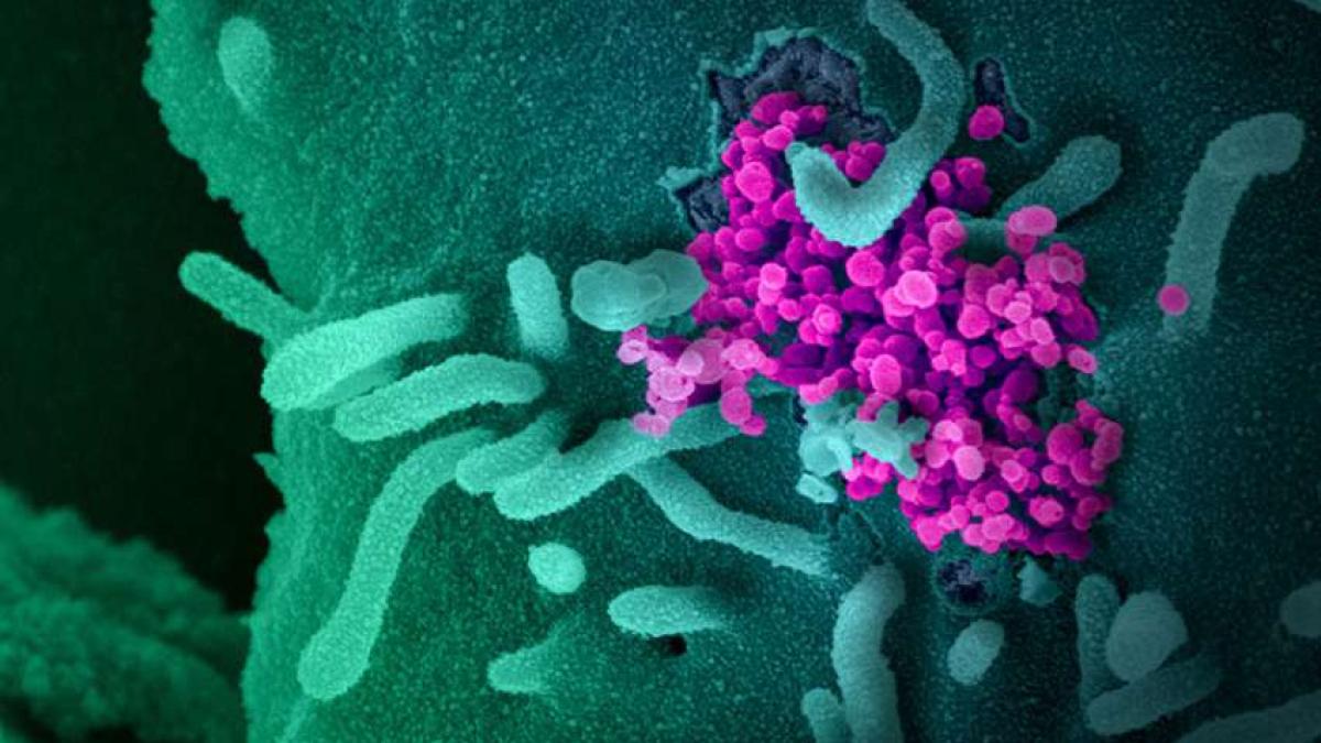 niaid_covid_electronmicroscope_website_10384200