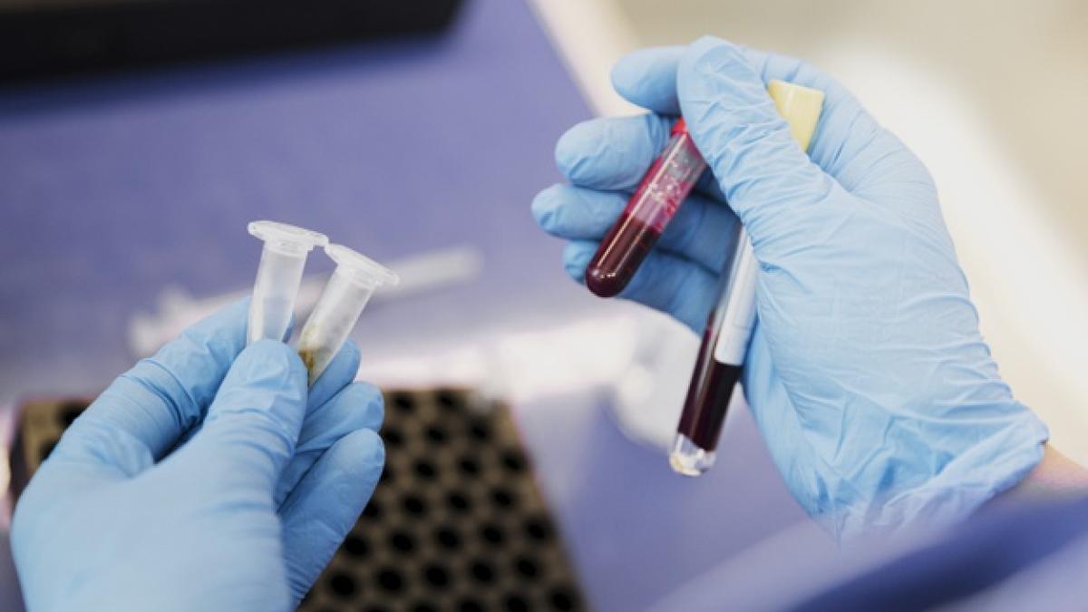 grupe_de_sange_99320100