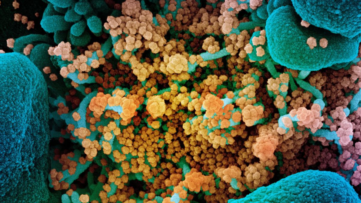 novel_coronavirus_sars_cov_2_50016121336_o_68608600