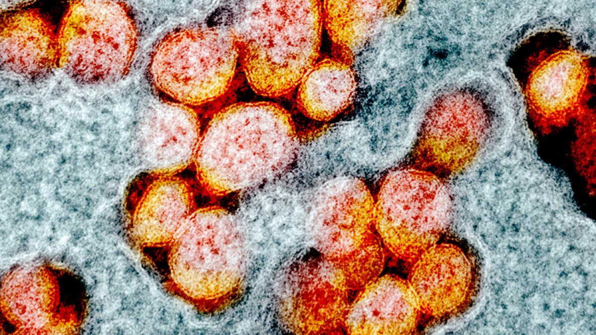 novel_coronavirus_sars_cov_2_49597020648_o_30687700