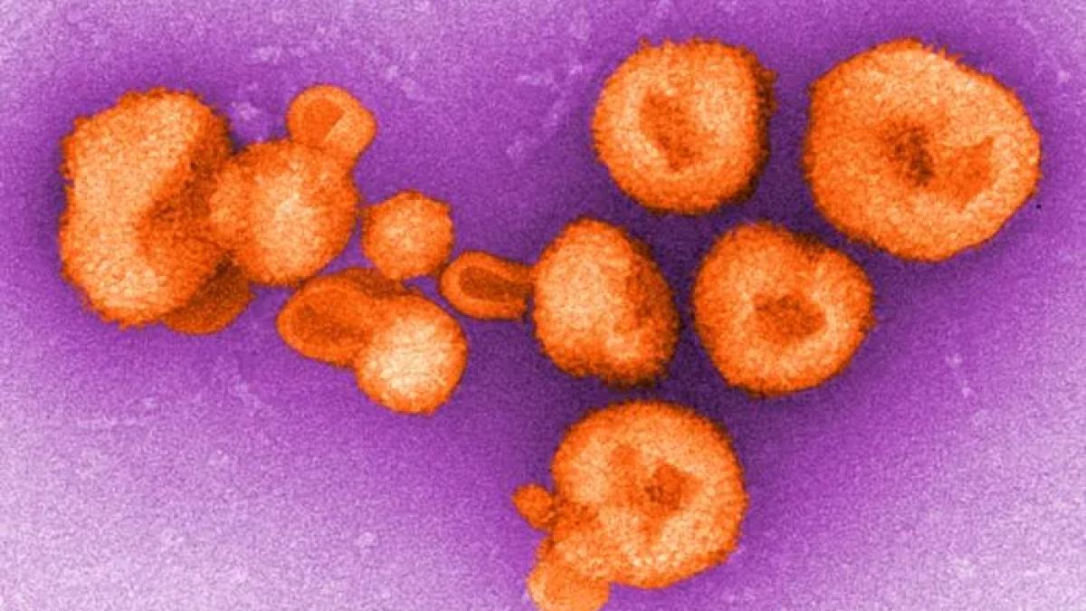 virus_chapare_que_sait_mysterieux_virus_qui_inquiete_les_scientifiques_41667400