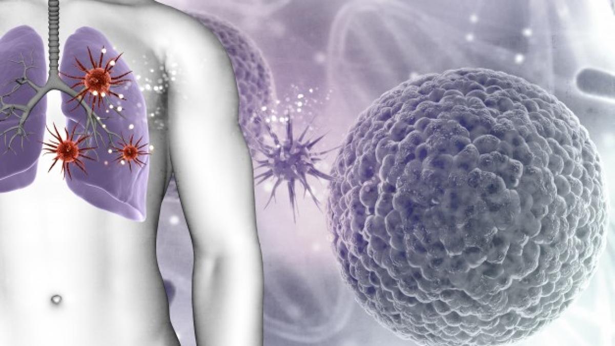 3d_render_medical_background_showing_virus_cells_male_figures_lungs_1048_6289_97812000