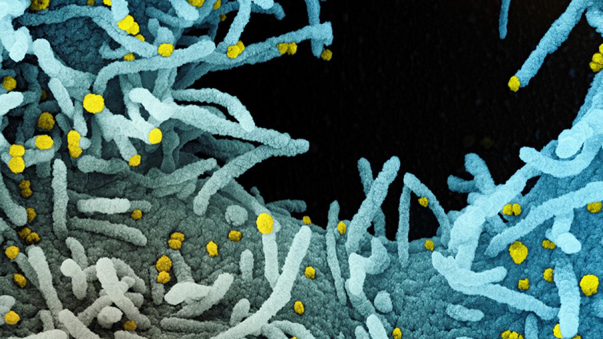 novel-coronavirus-sars-cov-2_50097879197_o_20210000