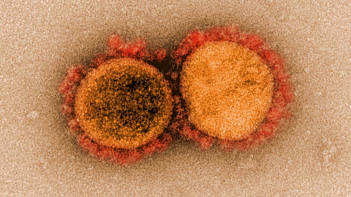 novel-coronavirus-sars-cov-2_49640655138_o_resize_28640200