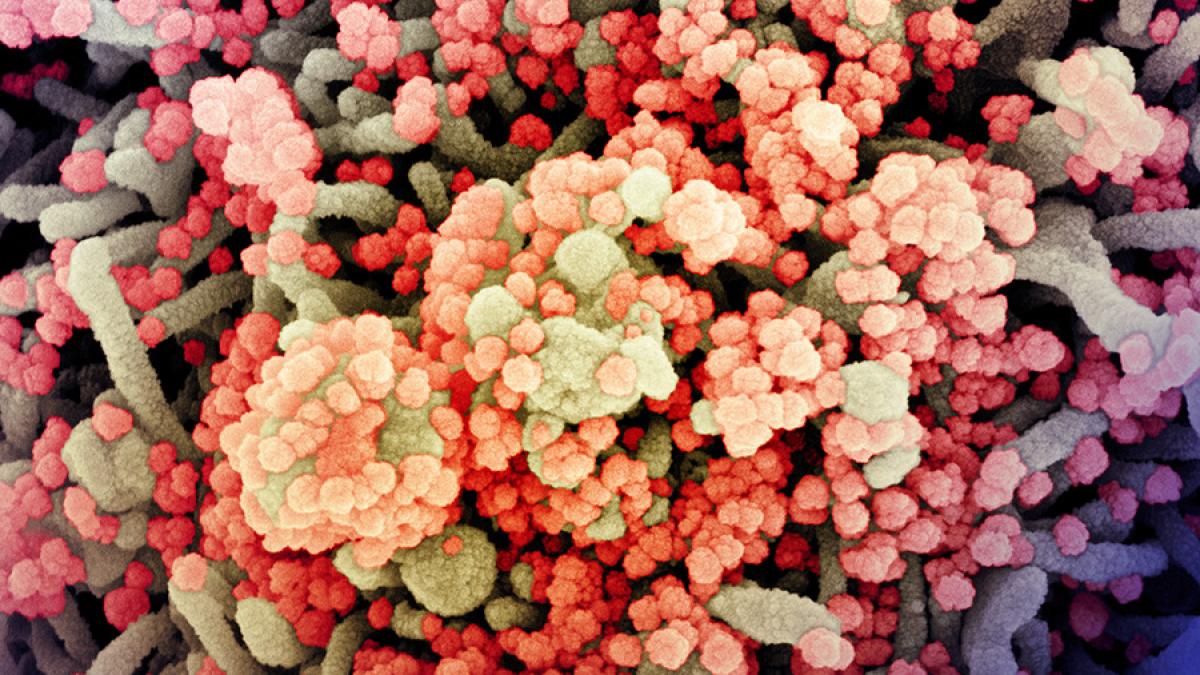 novel-coronavirus-sars-cov-2_50072570827_o_61562500