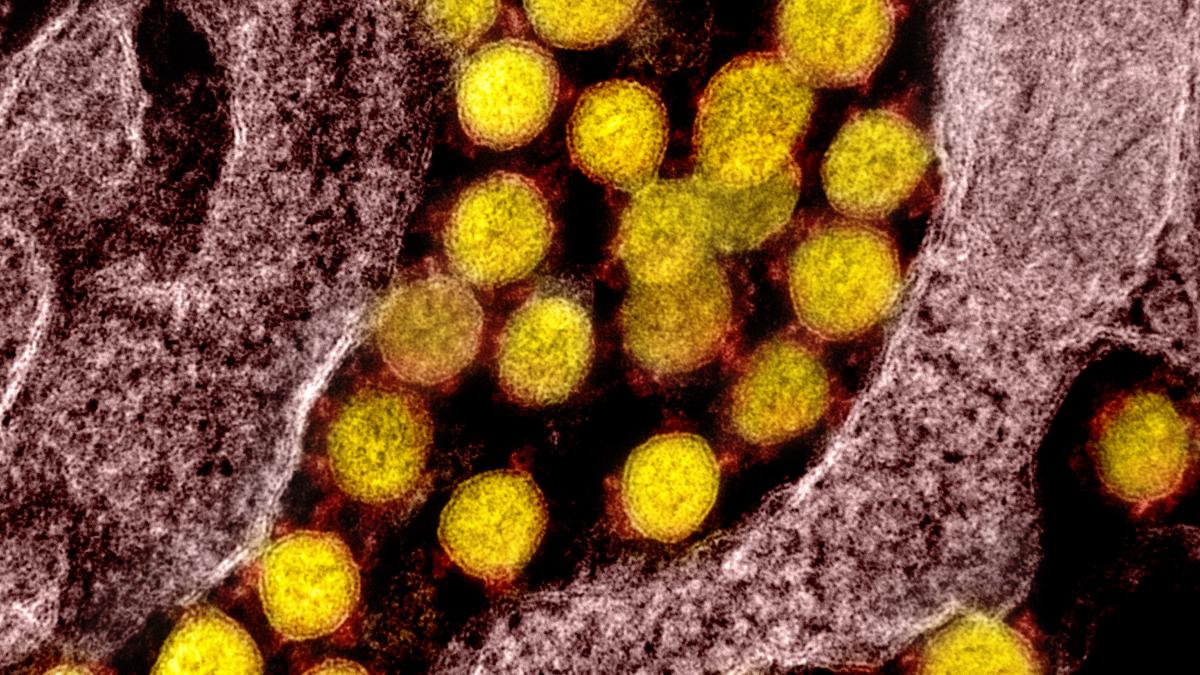 novel-coronavirus-sars-cov-2_49597020818_o_54079800