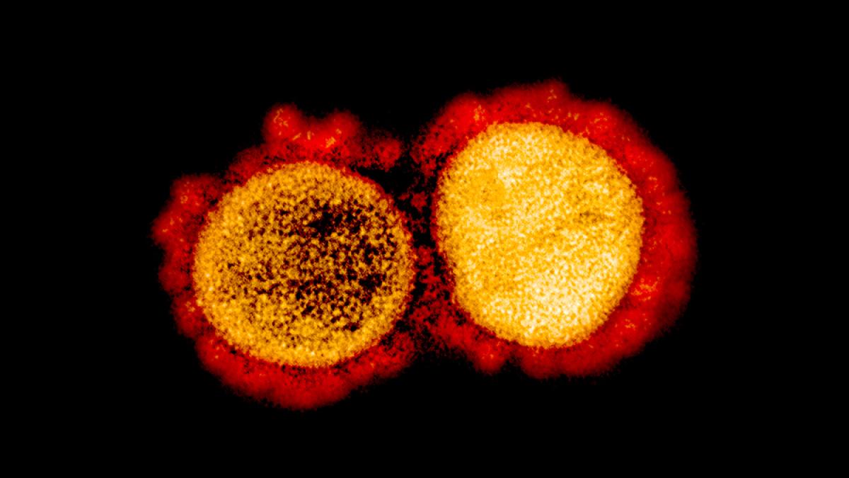 novel-coronavirus-sars-cov-2_49645402917_o_68728600