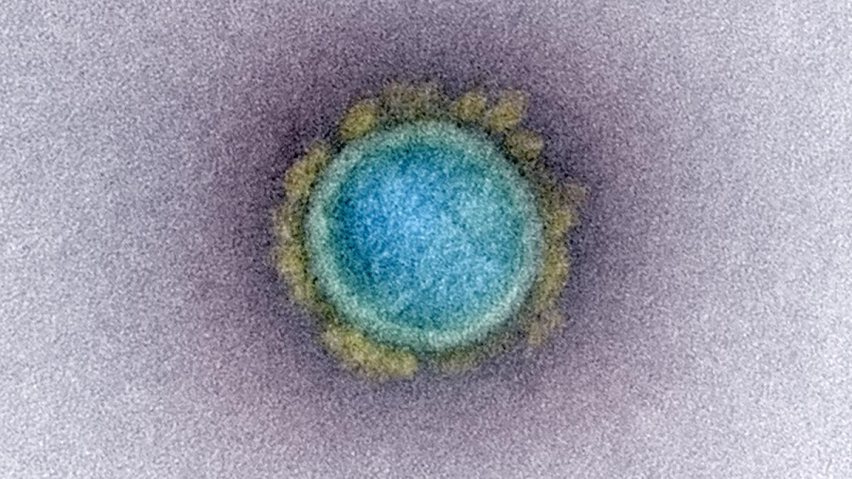 novel-coronavirus-sars-cov-2_49597768457_o_93943300