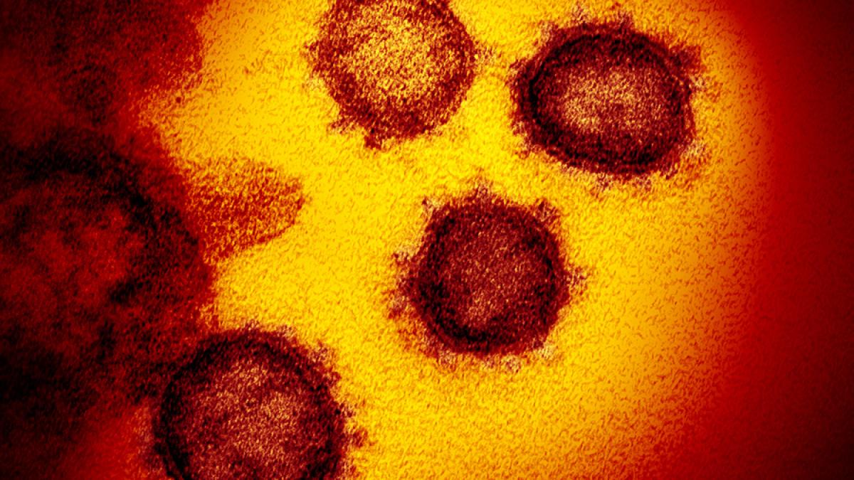 novel_coronavirus_sars_cov_2_49530315718_o_53762700
