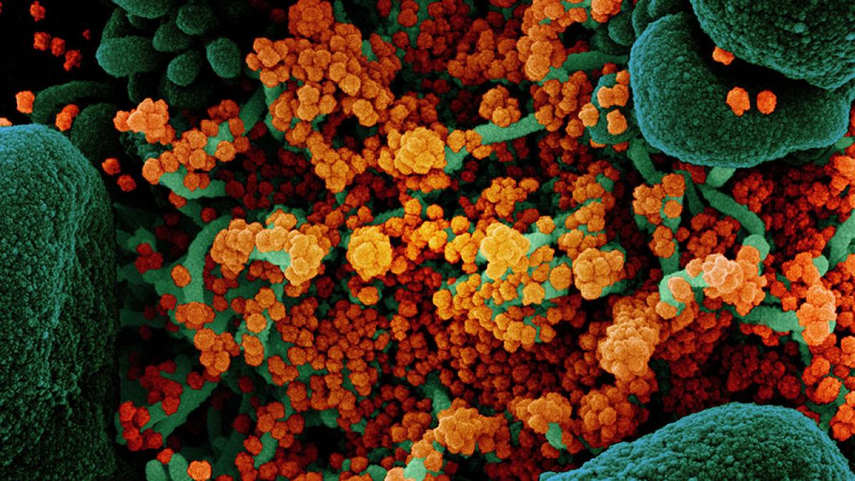 novel-coronavirus-sars-cov-2_50015591343_o_67717700