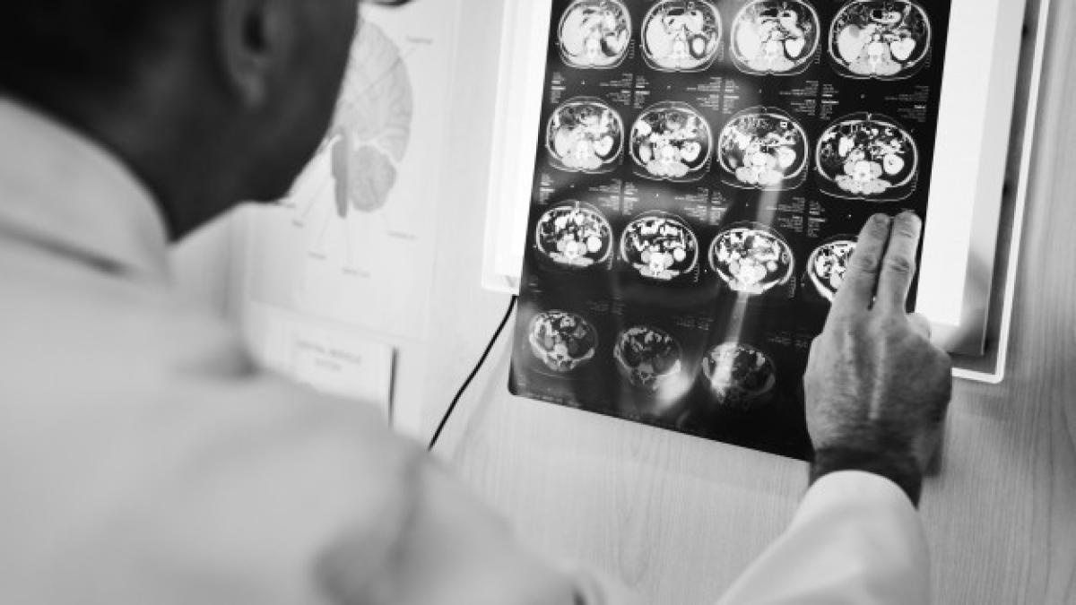 doctor-checking-x-ray-results_53876-20985_42545800