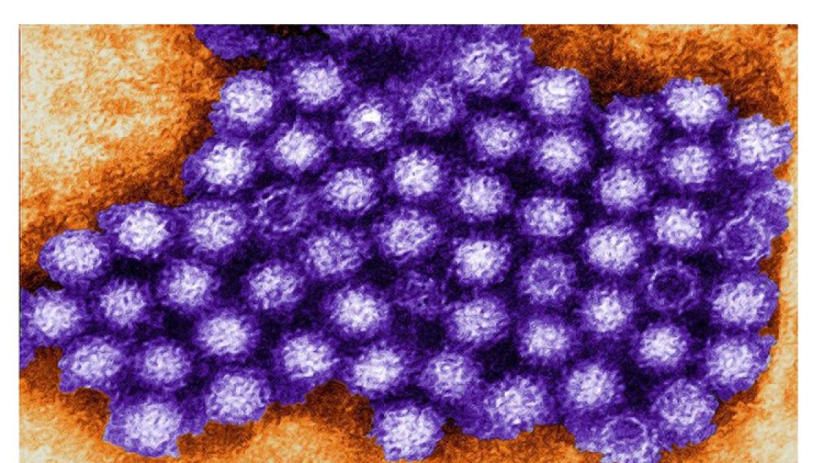 norovirus_74107700