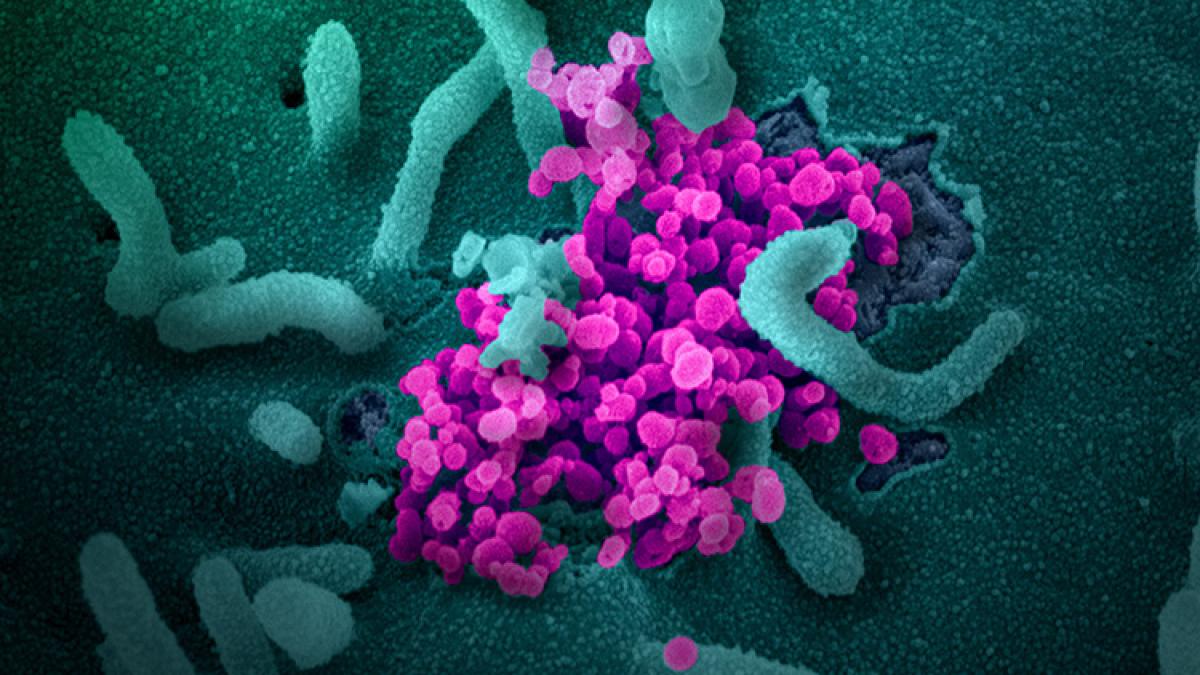 covid-19-microscop_26_66167600