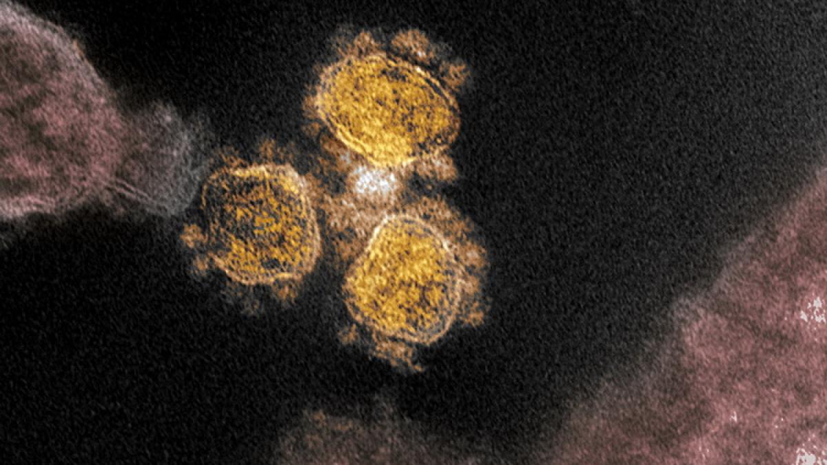 novel-coronavirus-sars-cov-2_49557550836_o_resize_46241300