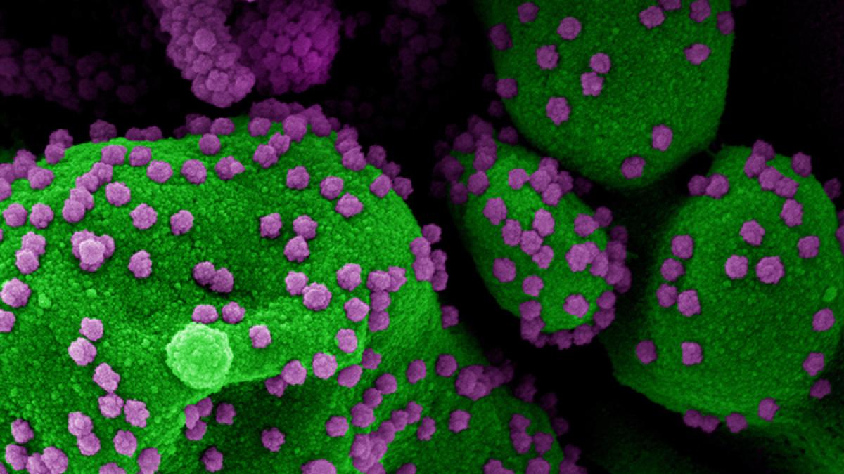 covid-19-microscop_71_10645200