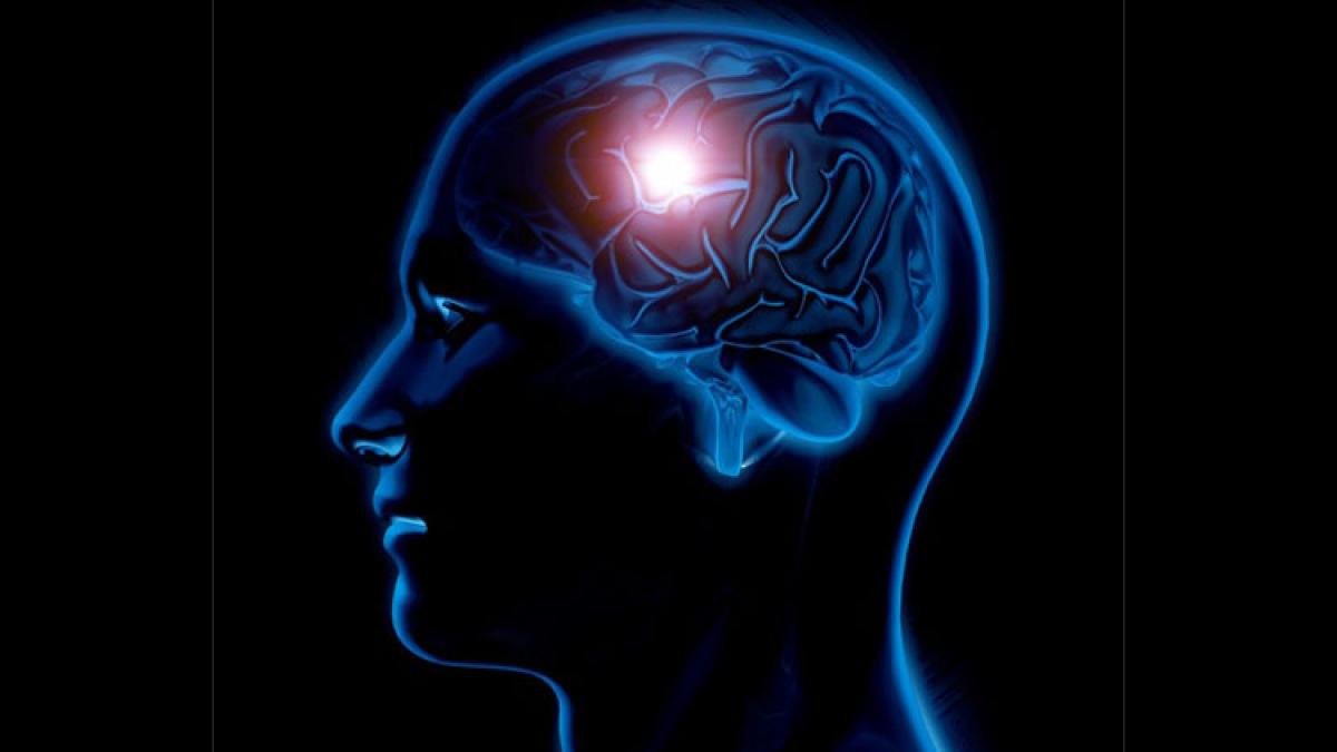 implanturiprc-e2prc-80prc-9e_08831800