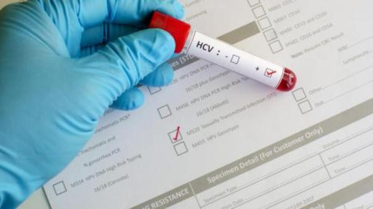 hepatita_c_tratament_fara_interferon_26709_69751700