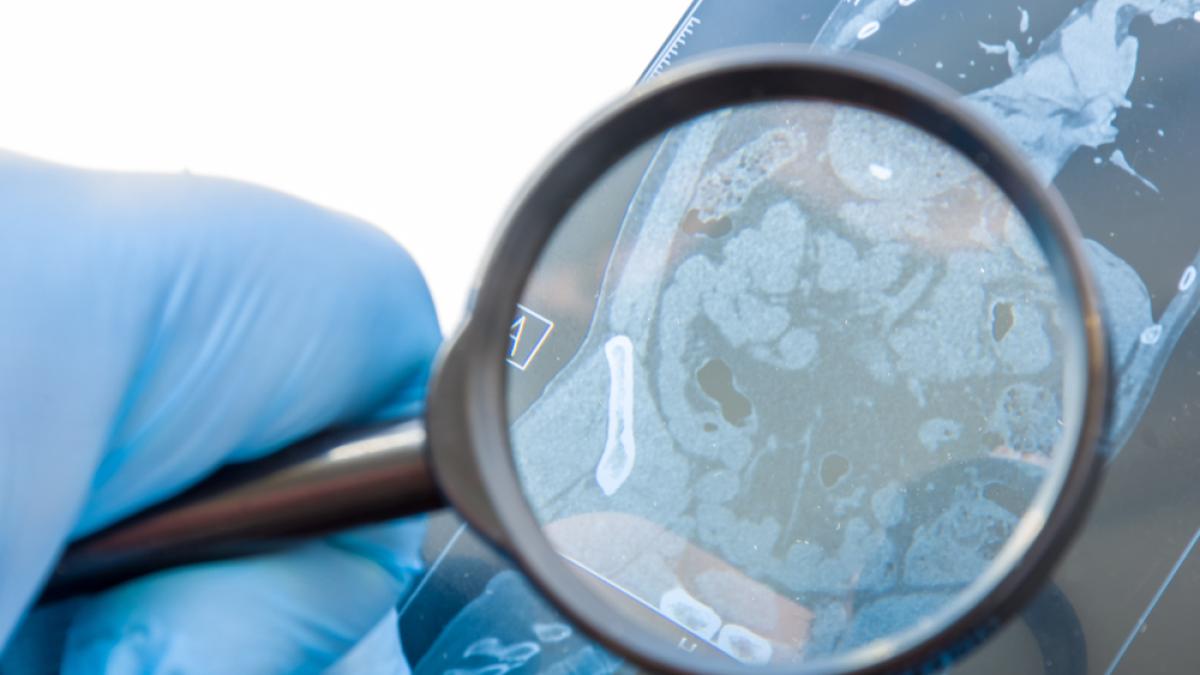 e131835bd28ca2c06930711faee9ceb69b_35048900