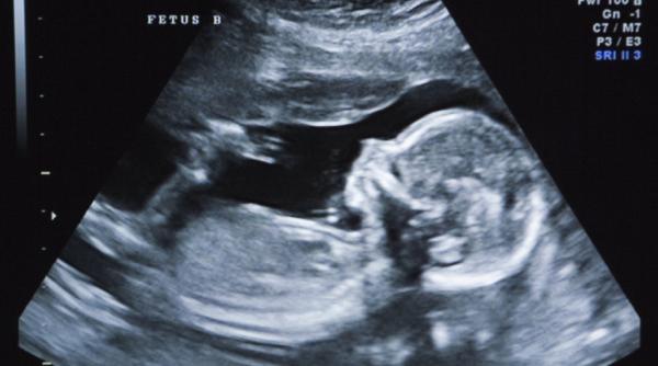 Al doilea bebeluș modificat genetic așteaptă să vină pe lume