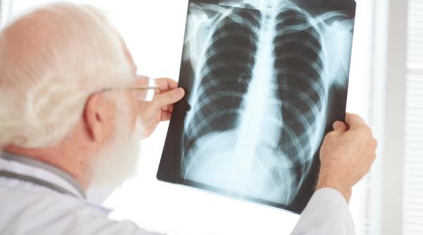 Ministerul Sănătăţii primește 4,3 milioane € pentru controlul tuberculozei