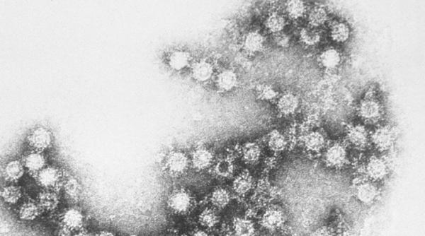 Virusul care i-a scos din minți pe cercetători. E ciudat
