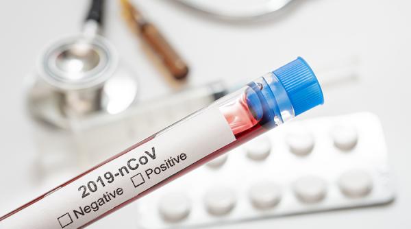 Covid-19. De ce în Germania mortalitatea este așa de scăzută