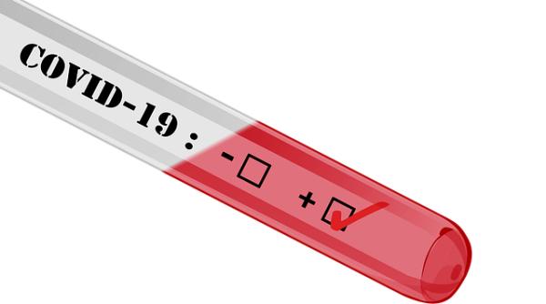 Coronavirus. Testul care poate depista covid-19 în câteva minute