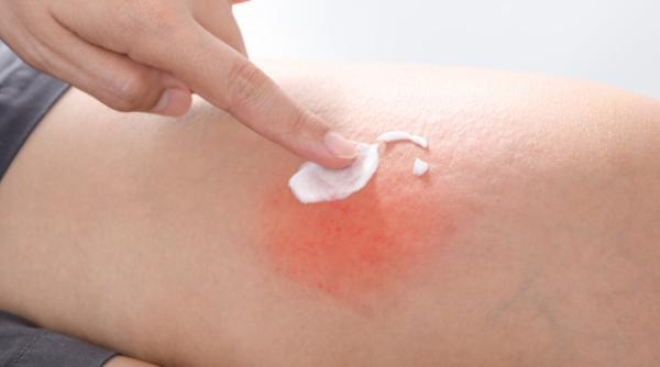 Covid-19 are noi simptome. Semnele se văd pe piele