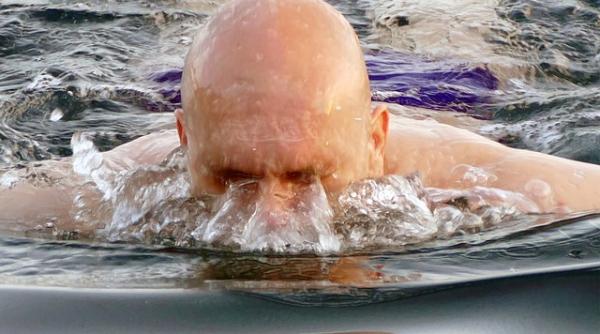 Bărbații cu chelie, mai expuși la covid-19? Părerea specialiștilor