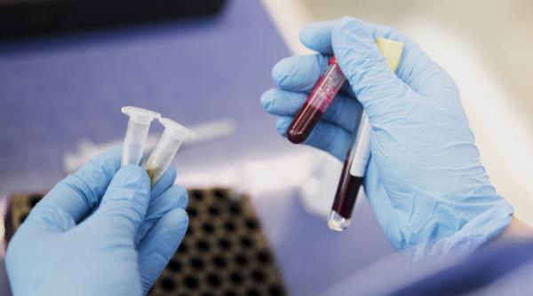 Virusul care face PRĂPĂD. Prof. dr. Pleșca: ”30% sunt asimptomatici”. Se poate ajunge la moarte