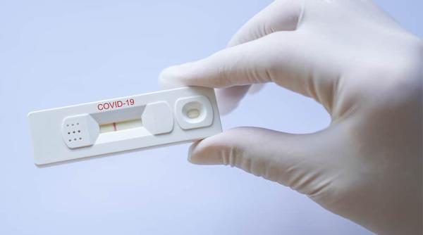 Covid-19. Teste serologice rapide, disponibile în farmacii