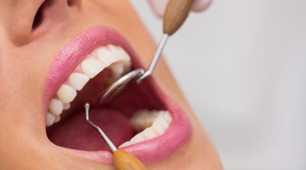 OMS vrea limitarea accesului la stomatologie. Se ÎNCHID cabinetele în România? OFICIAL: Poziția Colegiului Medicilor Stomatologi