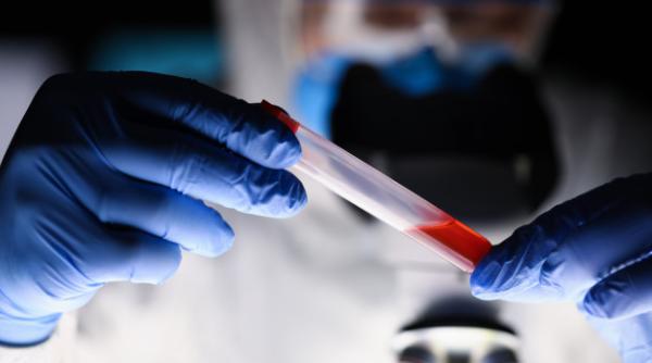 Noua MUTAȚIE a virusului Covid-19 se numește D614G