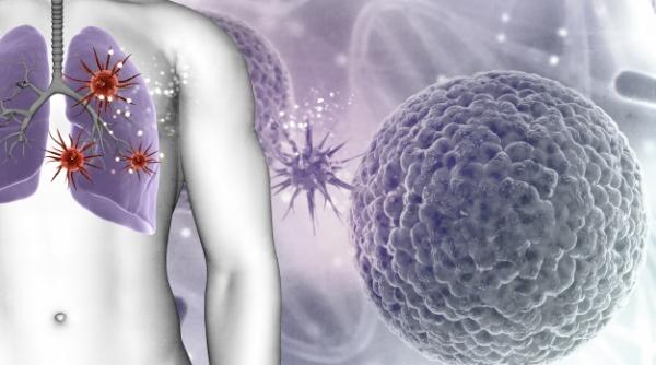 Covid-19. Soluție RADICALĂ pentru cei cu leziuni pulmonare grave