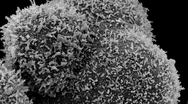 O nouă tulpină din Brazilia a ajuns în Japonia. Ce se știe despre noua variantă