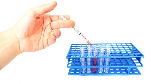 Șeful AstraZeneca, profund DEZAMĂGIT! Nu așa se procedează