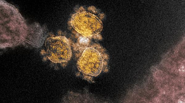 Un nou simptom de Covid-19 a fost descoperit la unii pacienți FOTO