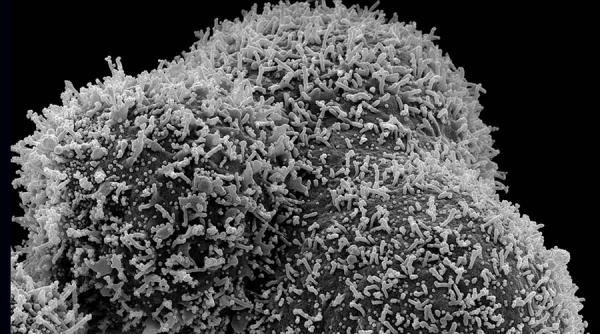 Covid-19. Descoperire șocantă a medicilor la pacienții din Brazilia