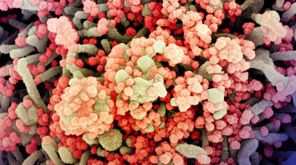 Amenințarea unui NOU coronavirus, mai mare decât ne așteptăm